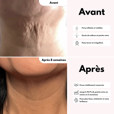 La Crème Cou & Décolleté