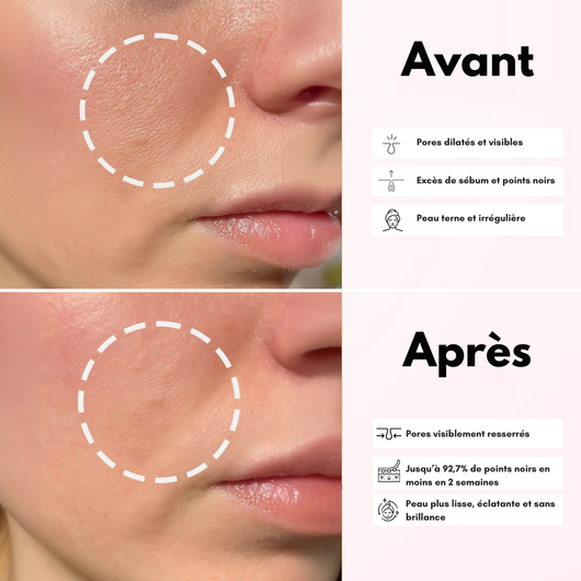 Sérum Exfoliant au Riz Noir